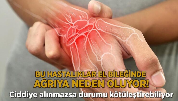 Bu hastalıklar el bileğinde ağrıya neden oluyor! Ciddiye alınmazsa durum kötüleşebiliyor